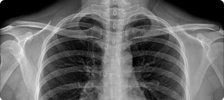 image-cxr