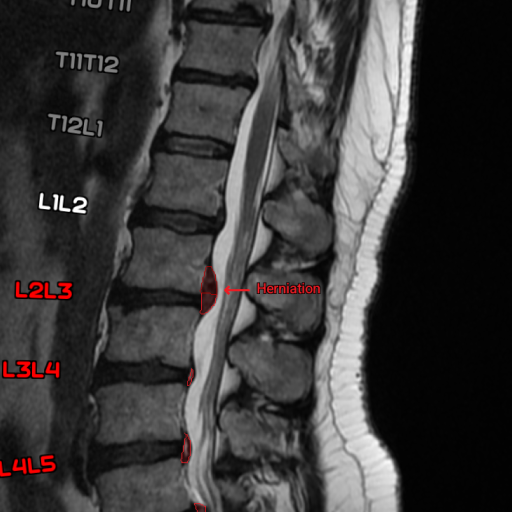 columbo-product-image
