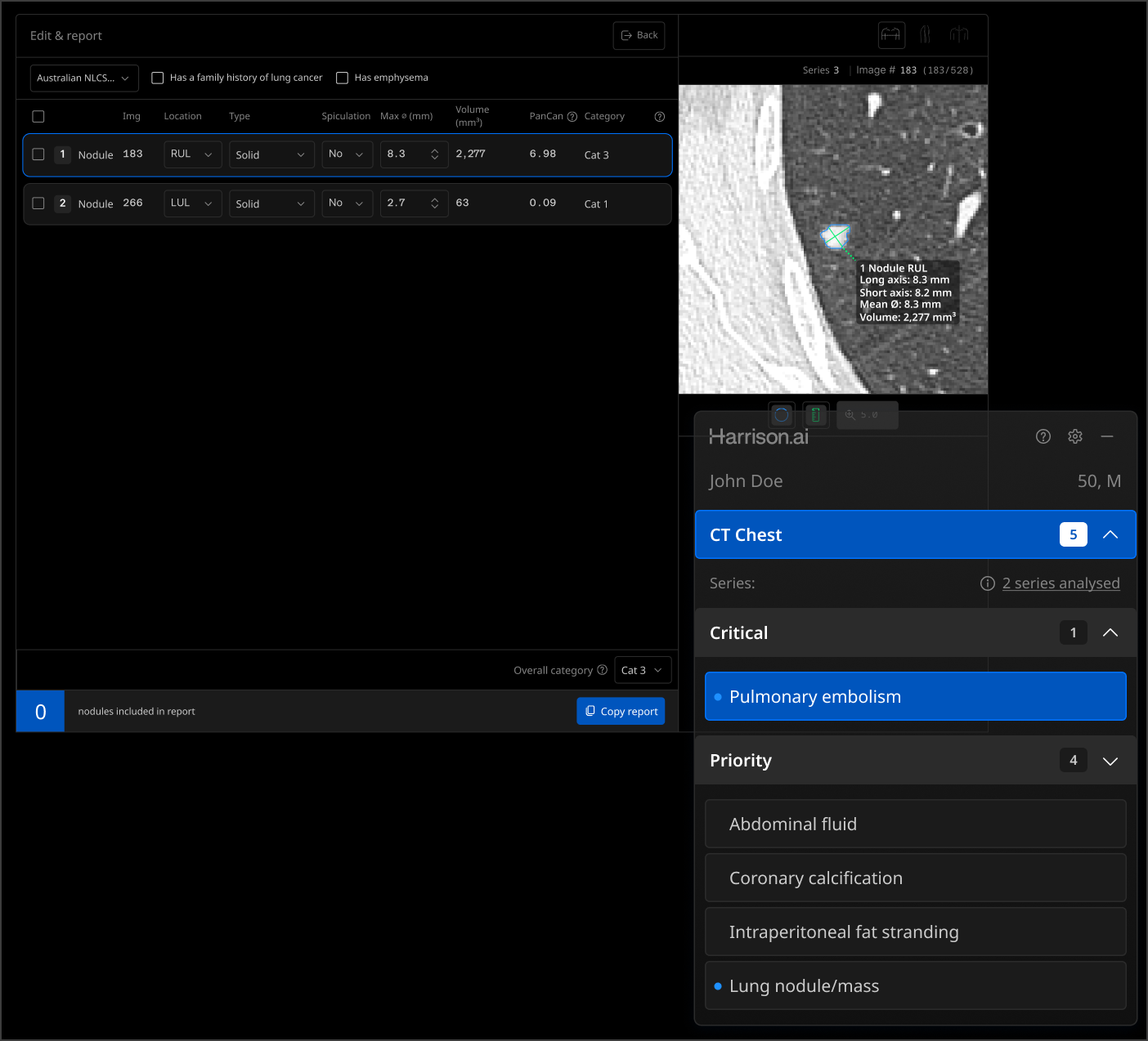 lung-screen-workflow