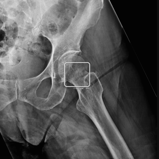 radiobotics-product-image