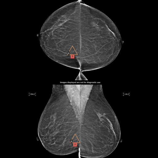 therapixel-product-image